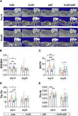 Differential effects of clopidogrel and/or aspirin on the healing of tooth extraction wound bone tissue